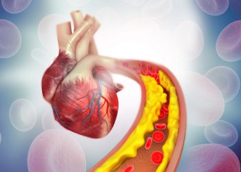 Ce trebuie să știi despre colesterolul mărit și cum îți poate afecta sănătatea