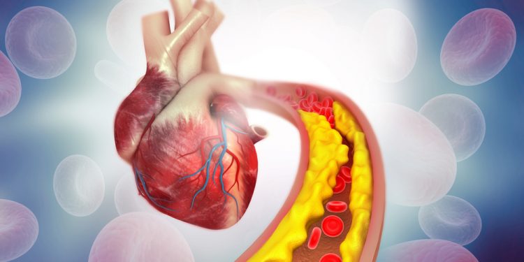 Ce trebuie să știi despre colesterolul mărit și cum îți poate afecta sănătatea